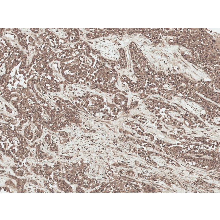 Immunohistochemistry - Anti-SFRP2 Antibody (A304925) - Antibodies.com