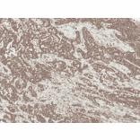 Immunohistochemistry - Anti-SFRP2 Antibody (A304925) - Antibodies.com