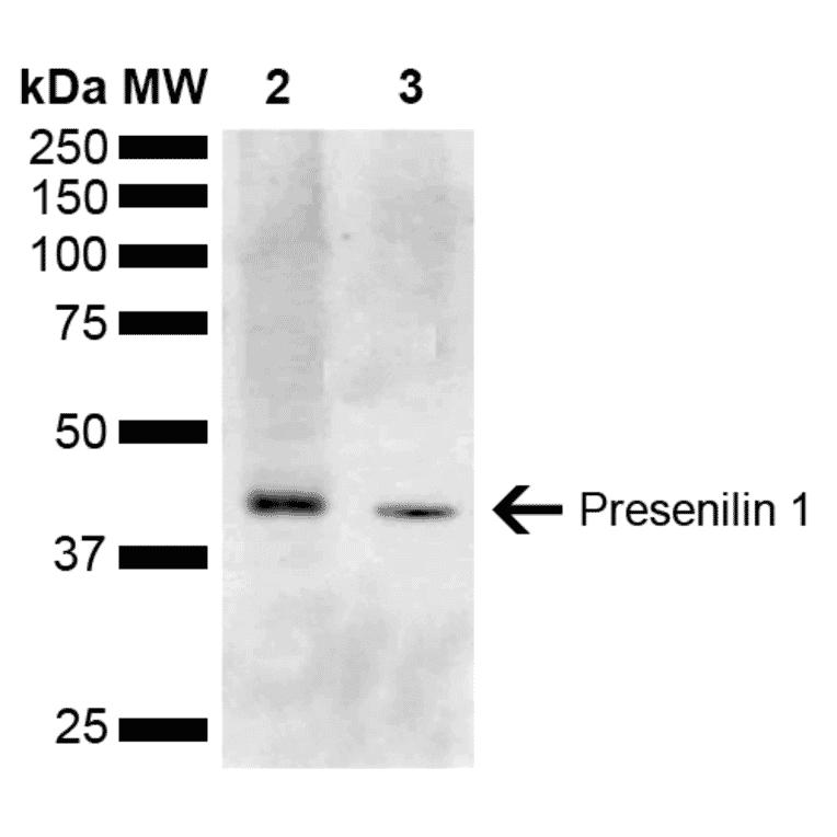 Western Blot - Anti-Presenilin 1 Antibody (A304926) - Antibodies.com