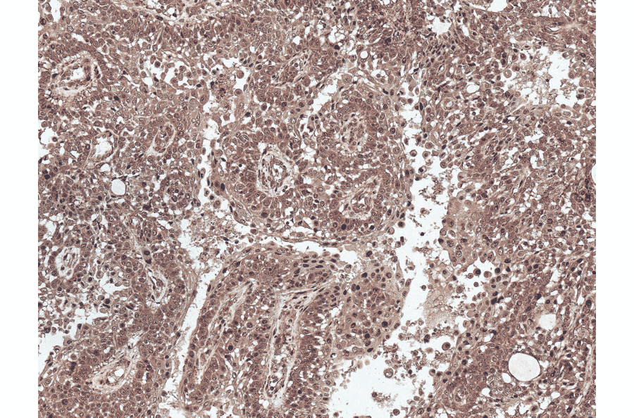Immunohistochemistry - Anti-Presenilin 1 Antibody (A304926) - Antibodies.com