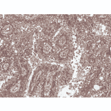 Immunohistochemistry - Anti-Presenilin 1 Antibody (A304926) - Antibodies.com