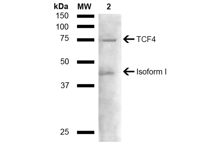 Western Blot - Anti-TCF4 Antibody (A304927) - Antibodies.com