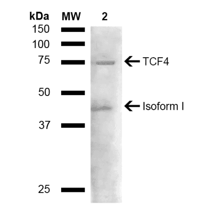 Western Blot - Anti-TCF4 Antibody (A304927) - Antibodies.com