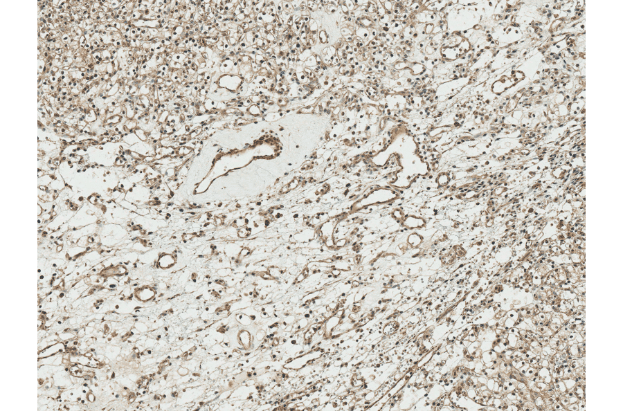 Immunohistochemistry - Anti-TCF4 Antibody (A304927) - Antibodies.com