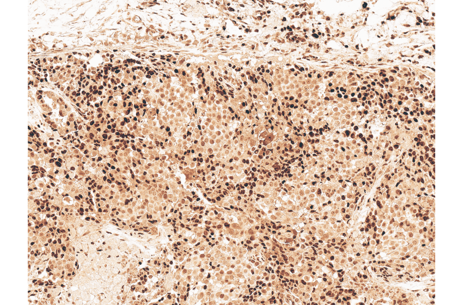 Immunohistochemistry - Anti-GSK3 beta Antibody (A304928) - Antibodies.com