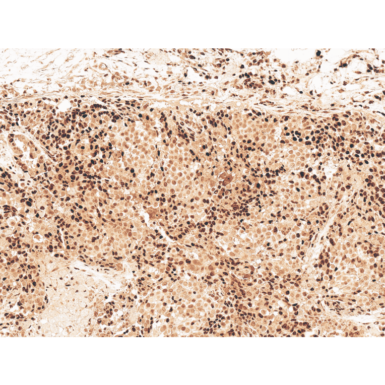 Immunohistochemistry - Anti-GSK3 beta Antibody (A304928) - Antibodies.com