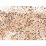 Immunohistochemistry - Anti-GSK3 beta Antibody (A304928) - Antibodies.com