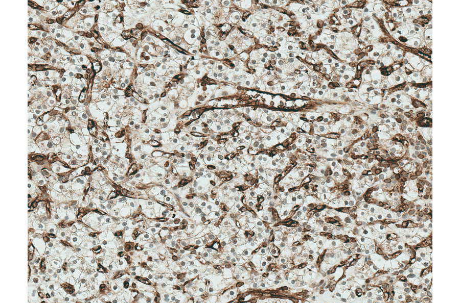 Immunohistochemistry - Anti-Frizzled 4 Antibody (A304930) - Antibodies.com