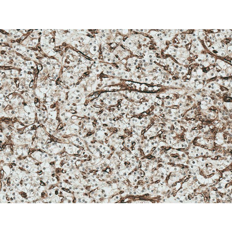 Immunohistochemistry - Anti-Frizzled 4 Antibody (A304930) - Antibodies.com