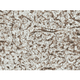 Immunohistochemistry - Anti-Frizzled 4 Antibody (A304930) - Antibodies.com
