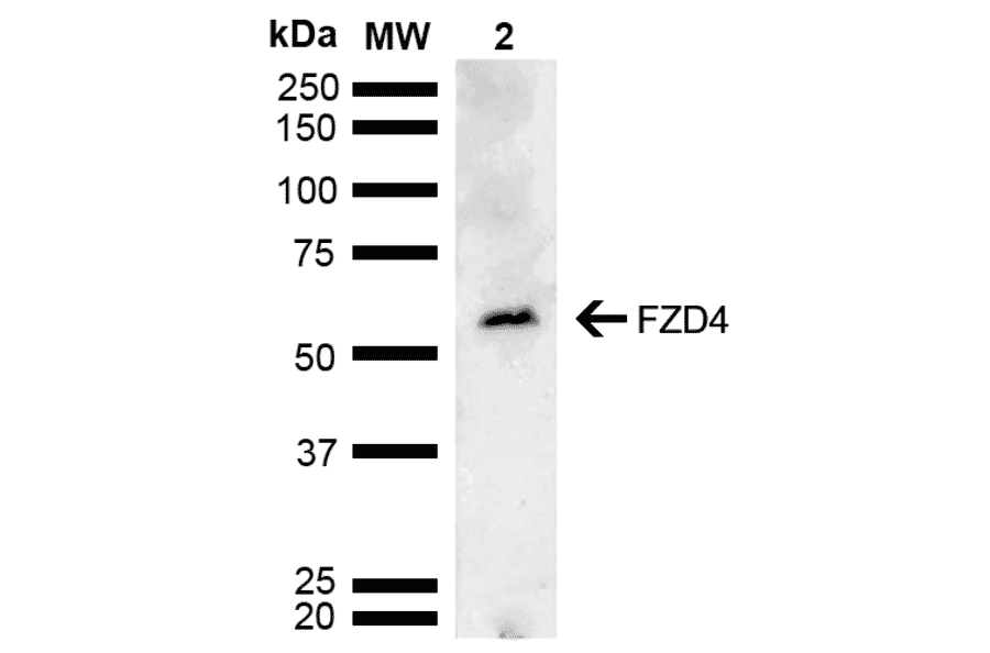 Western Blot - Anti-Frizzled 4 Antibody (A304930) - Antibodies.com