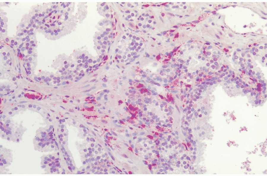 Immunohistochemistry - Anti-Frizzled 4 Antibody (A304930) - Antibodies.com