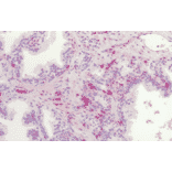 Immunohistochemistry - Anti-Frizzled 4 Antibody (A304930) - Antibodies.com