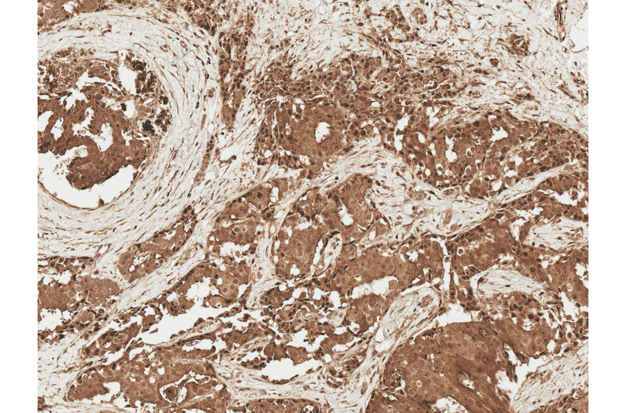 Immunohistochemistry - Anti-AKT1 Antibody (A304932) - Antibodies.com
