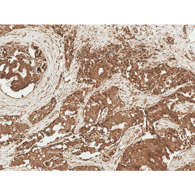 Immunohistochemistry - Anti-AKT1 Antibody (A304932) - Antibodies.com