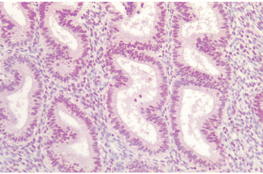 Immunohistochemistry - Anti-AKT1 Antibody (A304932) - Antibodies.com
