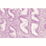 Immunohistochemistry - Anti-AKT1 Antibody (A304932) - Antibodies.com