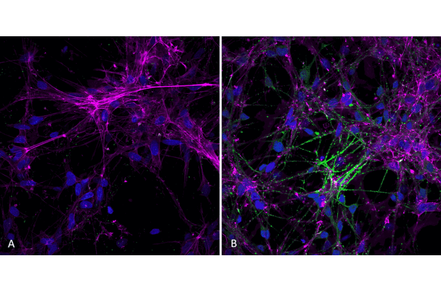 Immunocytochemistry/Immunofluorescence - Anti-alpha Synuclein (phospho Ser129) Antibody [J18] (A304933) - Antibodies.com