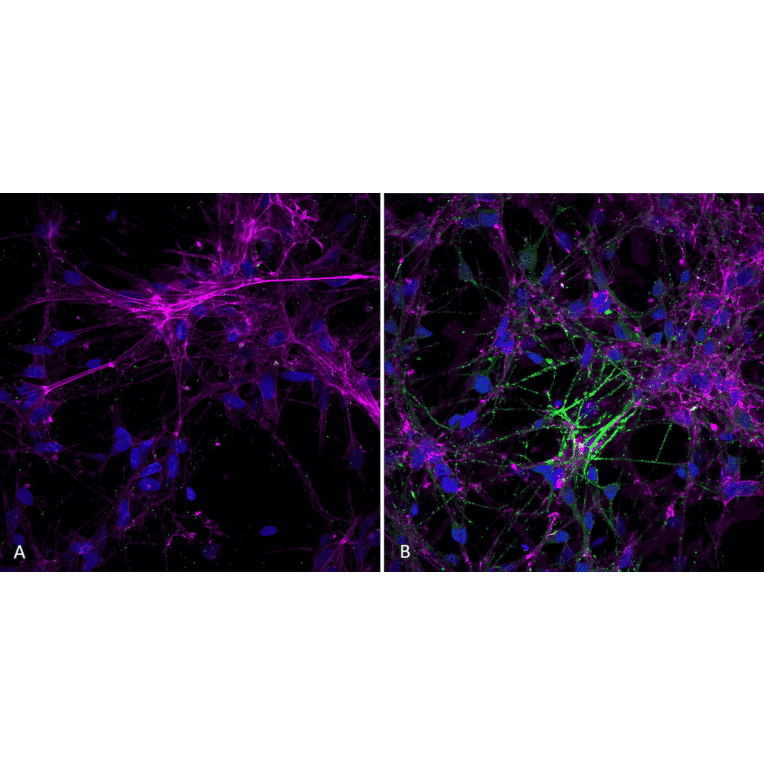 Immunocytochemistry/Immunofluorescence - Anti-alpha Synuclein (phospho Ser129) Antibody [J18] (A304933) - Antibodies.com