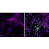 Immunocytochemistry/Immunofluorescence - Anti-alpha Synuclein (phospho Ser129) Antibody [J18] (A304933) - Antibodies.com