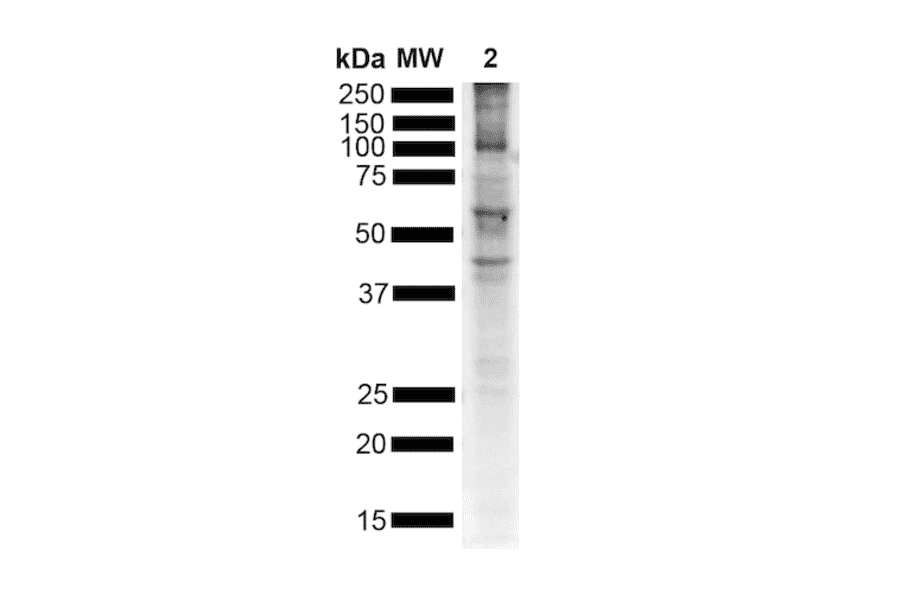Western Blot - Anti-alpha Synuclein (phospho Ser129) Antibody [J18] (A304933) - Antibodies.com