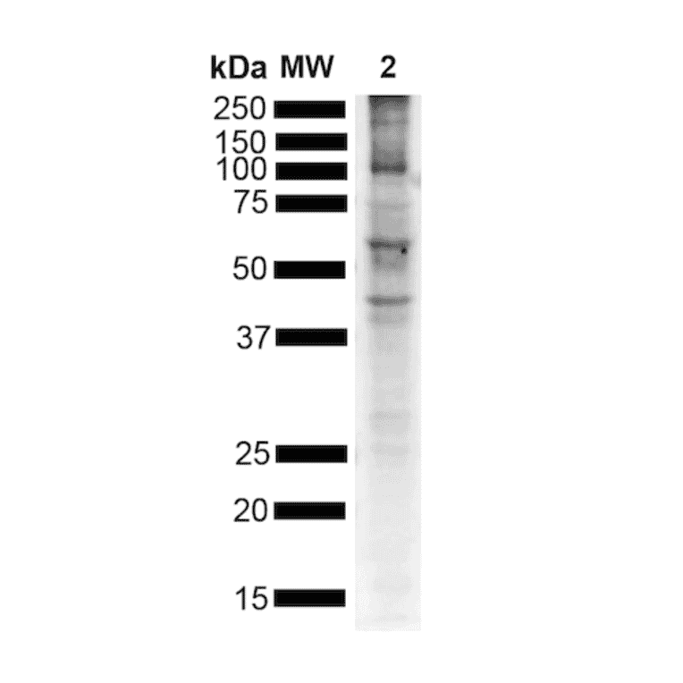 Western Blot - Anti-alpha Synuclein (phospho Ser129) Antibody [J18] (A304933) - Antibodies.com