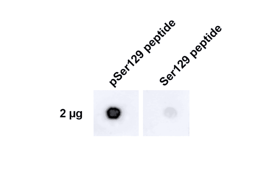 Dot Blot - Anti-alpha Synuclein (phospho Ser129) Antibody [J18] (A304933) - Antibodies.com