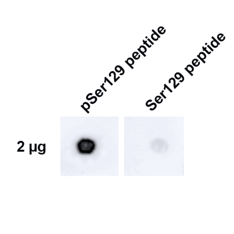 Dot Blot - Anti-alpha Synuclein (phospho Ser129) Antibody [J18] (A304933) - Antibodies.com