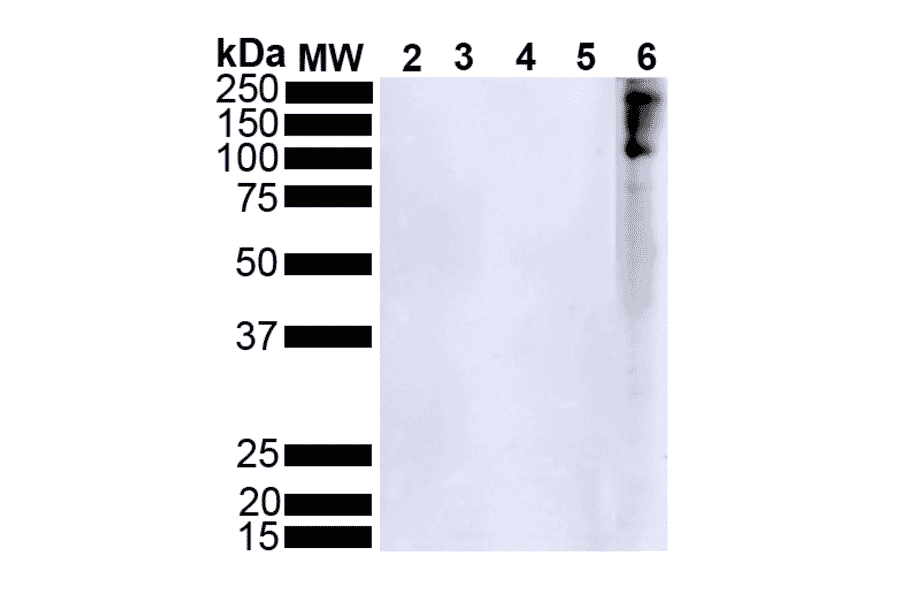 Western Blot - Anti-alpha Synuclein (phospho Ser129) Antibody [J18] (A304933) - Antibodies.com