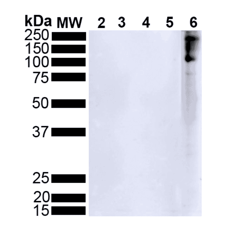 Western Blot - Anti-alpha Synuclein (phospho Ser129) Antibody [J18] (A304933) - Antibodies.com