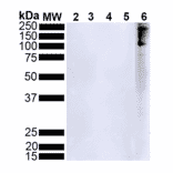 Western Blot - Anti-alpha Synuclein (phospho Ser129) Antibody [J18] (A304933) - Antibodies.com