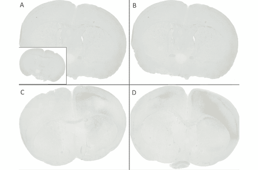 Immunohistochemistry - Anti-alpha Synuclein (phospho Ser129) Antibody [J18] (A304933) - Antibodies.com