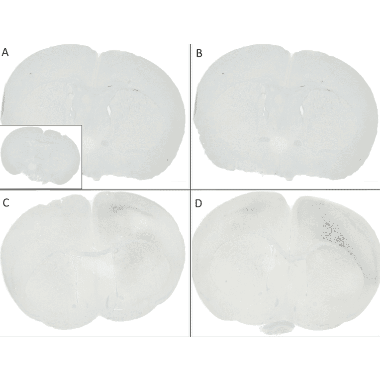 Immunohistochemistry - Anti-alpha Synuclein (phospho Ser129) Antibody [J18] (A304933) - Antibodies.com