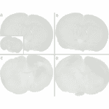 Immunohistochemistry - Anti-alpha Synuclein (phospho Ser129) Antibody [J18] (A304933) - Antibodies.com