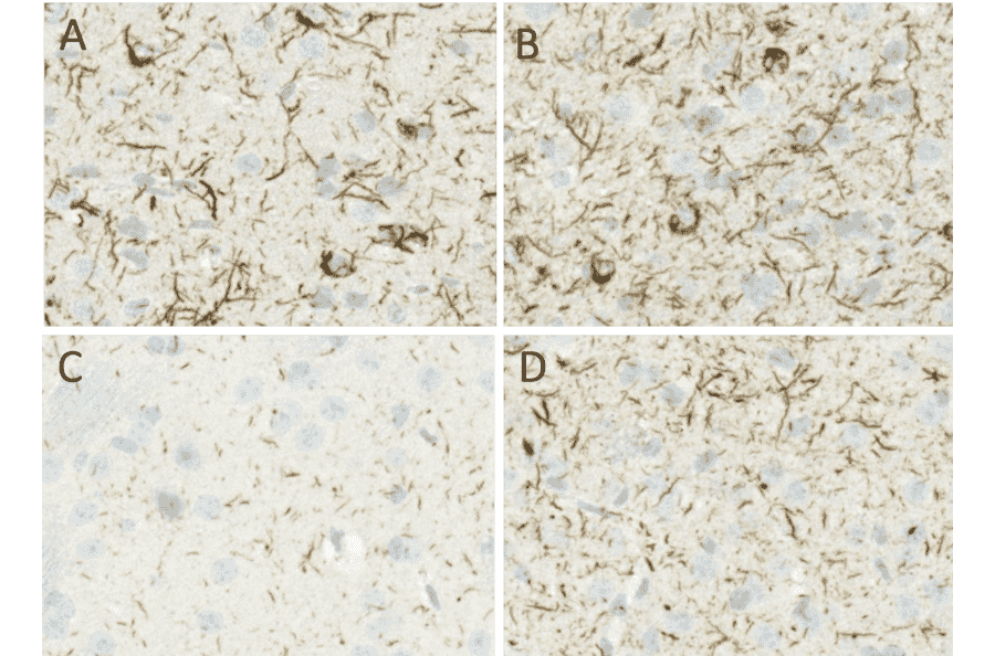 Immunohistochemistry - Anti-alpha Synuclein (phospho Ser129) Antibody [J18] (A304933) - Antibodies.com