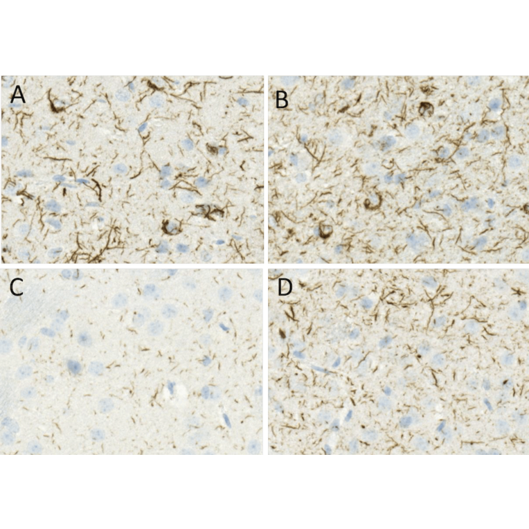 Immunohistochemistry - Anti-alpha Synuclein (phospho Ser129) Antibody [J18] (A304933) - Antibodies.com