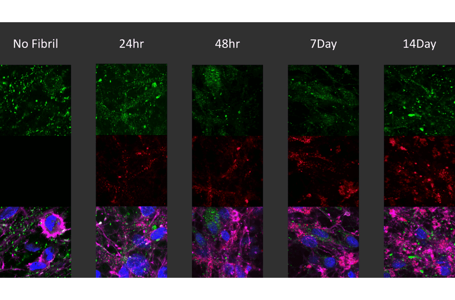Immunocytochemistry/Immunofluorescence - Anti-alpha Synuclein (phospho Ser129) Antibody [J18] (A304933) - Antibodies.com