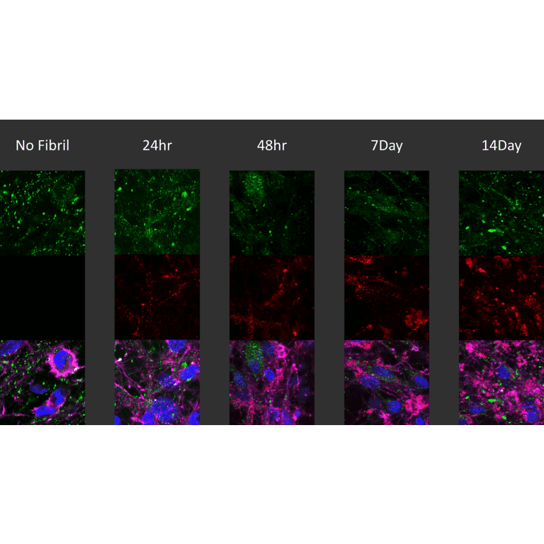 Immunocytochemistry/Immunofluorescence - Anti-alpha Synuclein (phospho Ser129) Antibody [J18] (A304933) - Antibodies.com