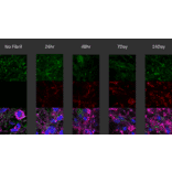 Immunocytochemistry/Immunofluorescence - Anti-alpha Synuclein (phospho Ser129) Antibody [J18] (A304933) - Antibodies.com