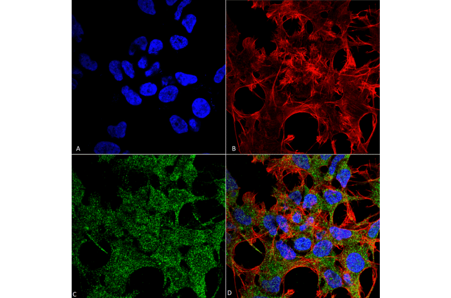 Immunocytochemistry/Immunofluorescence - Anti-GABARAP Antibody (A304934) - Antibodies.com