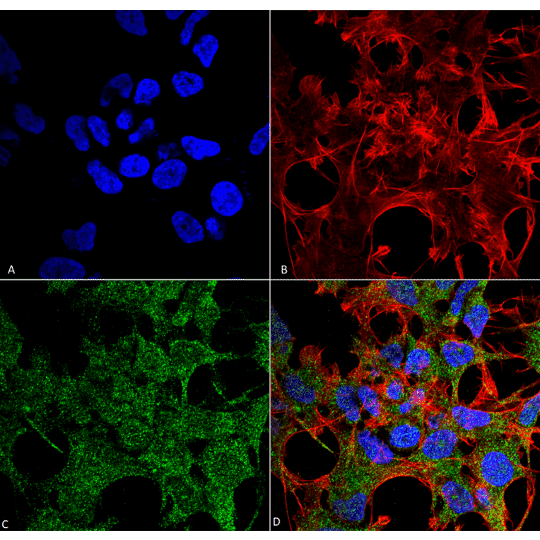 Immunocytochemistry/Immunofluorescence - Anti-GABARAP Antibody (A304934) - Antibodies.com