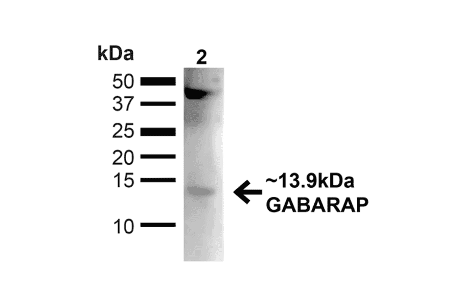 Western Blot - Anti-GABARAP Antibody (A304935) - Antibodies.com