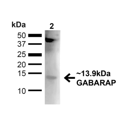 Western Blot - Anti-GABARAP Antibody (A304935) - Antibodies.com