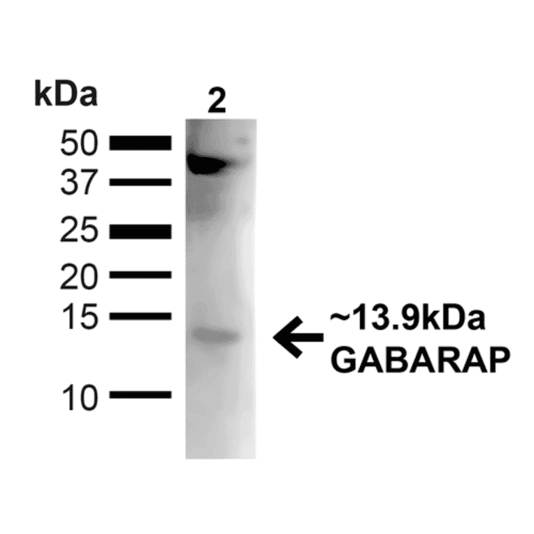 Western Blot - Anti-GABARAP Antibody (A304935) - Antibodies.com