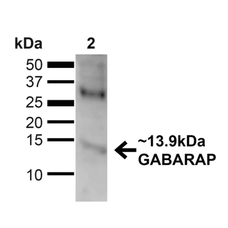 Western Blot - Anti-GABARAP Antibody (A304935) - Antibodies.com