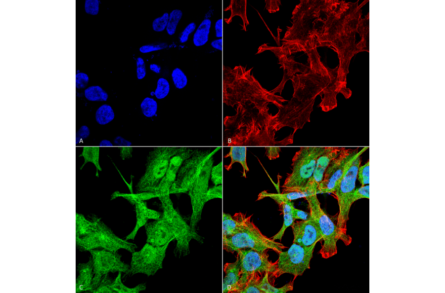 Immunocytochemistry/Immunofluorescence - Anti-GABARAP Antibody (A304935) - Antibodies.com