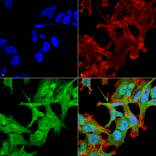 Immunocytochemistry/Immunofluorescence - Anti-GABARAP Antibody (A304935) - Antibodies.com