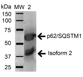 Western Blot - Anti-SQSTM1 / p62 Antibody (A304938) - Antibodies.com