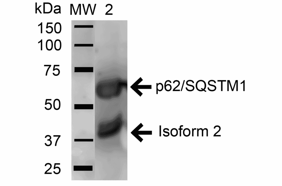 Western Blot - Anti-SQSTM1 / p62 Antibody (A304938) - Antibodies.com