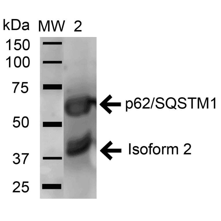 Western Blot - Anti-SQSTM1 / p62 Antibody (A304938) - Antibodies.com